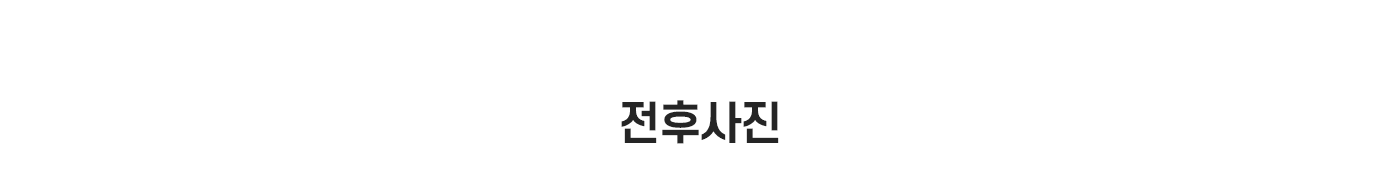 전후사진